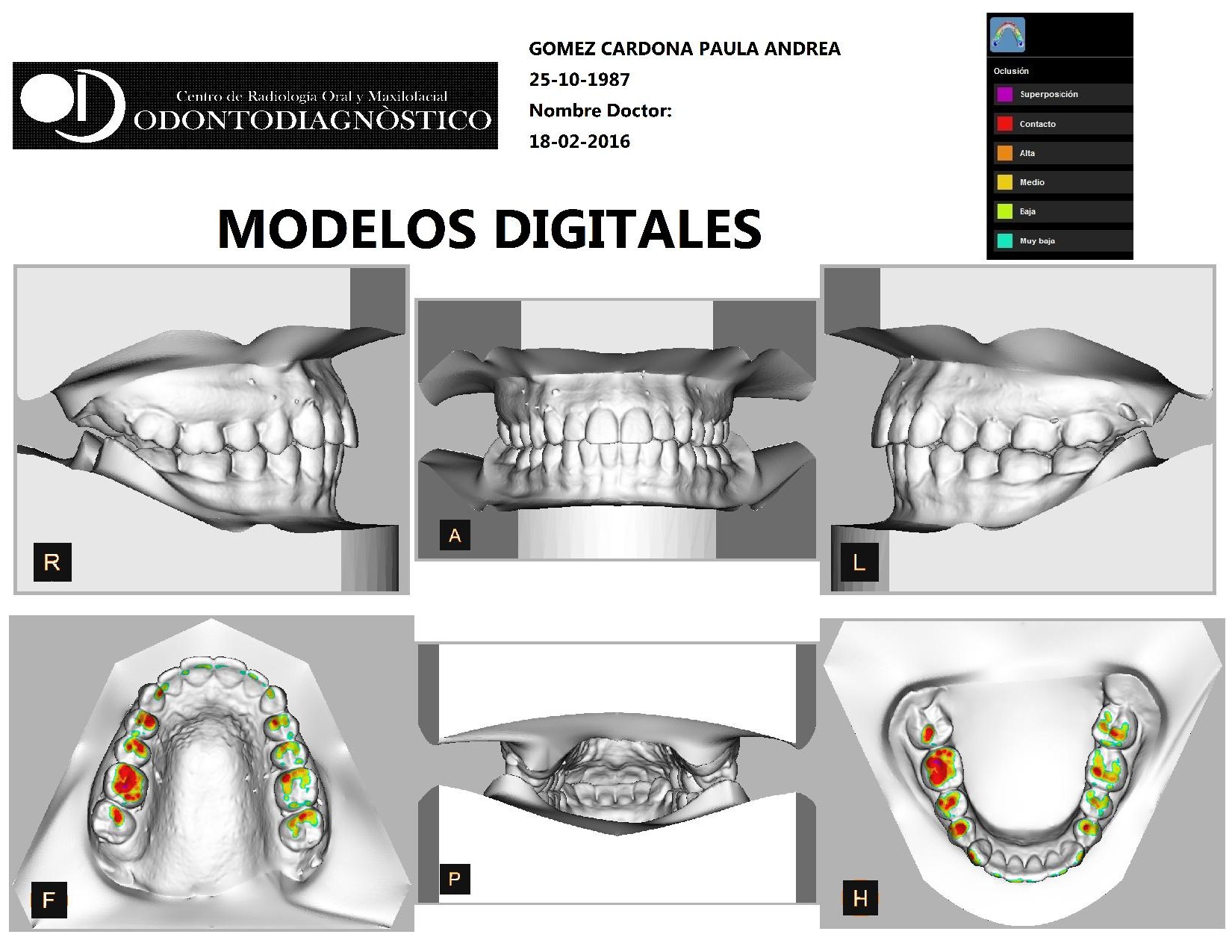 Radiografía de Perfil